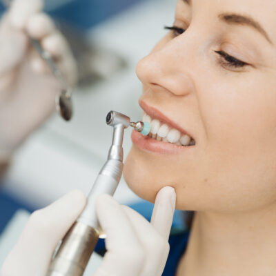 Overview of dental caries prevention. Girl at the dentist chair during a dental scaling procedure. Healthy Smile.